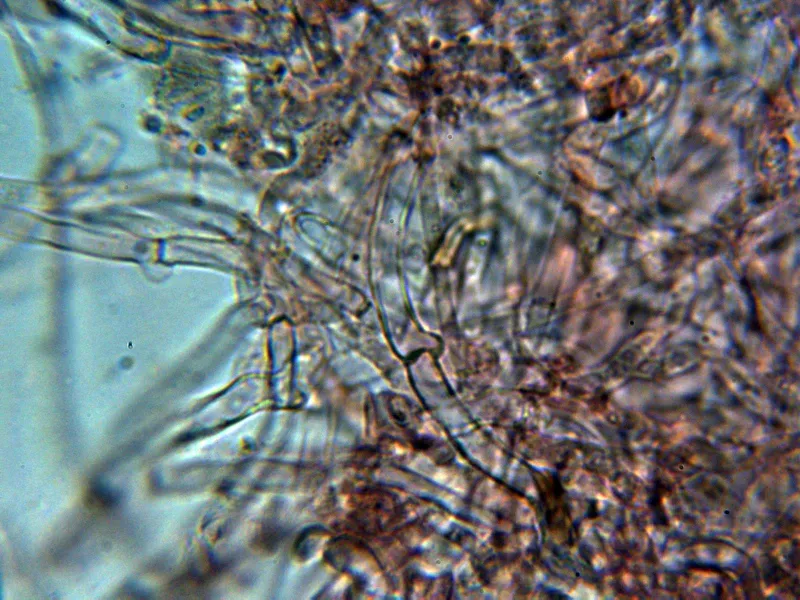 Calocybe gambosa 6 - Suprapellis 1